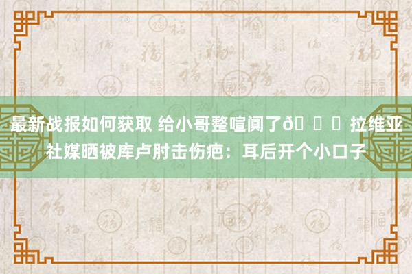 最新战报如何获取 给小哥整喧阗了😅拉维亚社媒晒被库卢肘击伤疤：耳后开个小口子